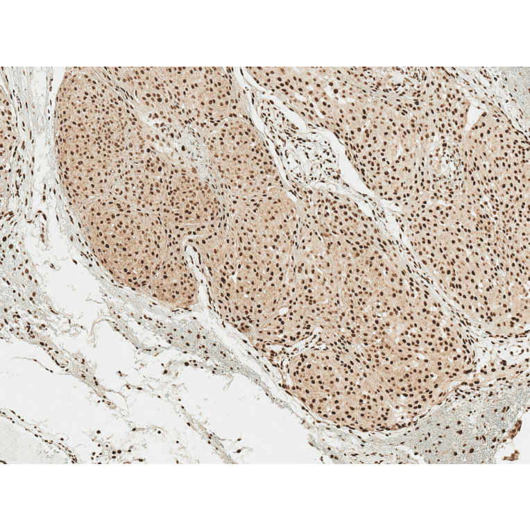 Immunohistochemistry - Anti-alpha Synuclein (phospho Ser129) Antibody (A305044) - Antibodies.com