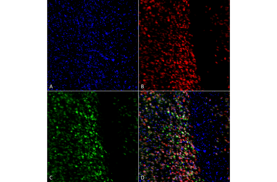 Immunocytochemistry/Immunofluorescence - Anti-alpha Synuclein (phospho Ser129) Antibody (A305044) - Antibodies.com