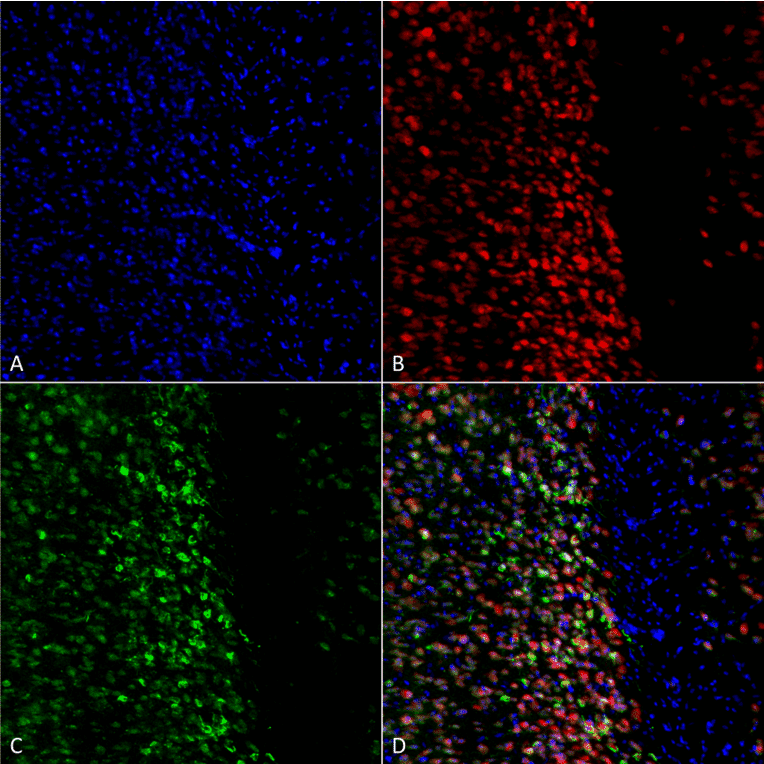 Immunocytochemistry/Immunofluorescence - Anti-alpha Synuclein (phospho Ser129) Antibody (A305044) - Antibodies.com