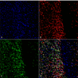 Immunocytochemistry/Immunofluorescence - Anti-alpha Synuclein (phospho Ser129) Antibody (A305044) - Antibodies.com