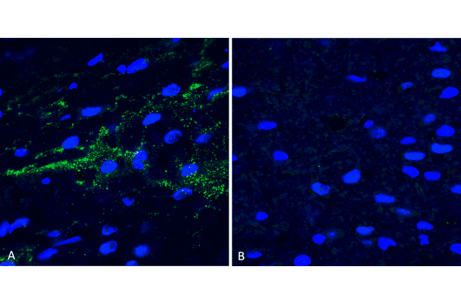 Immunohistochemistry - Anti-alpha Synuclein (phospho Ser129) Antibody (A305044) - Antibodies.com
