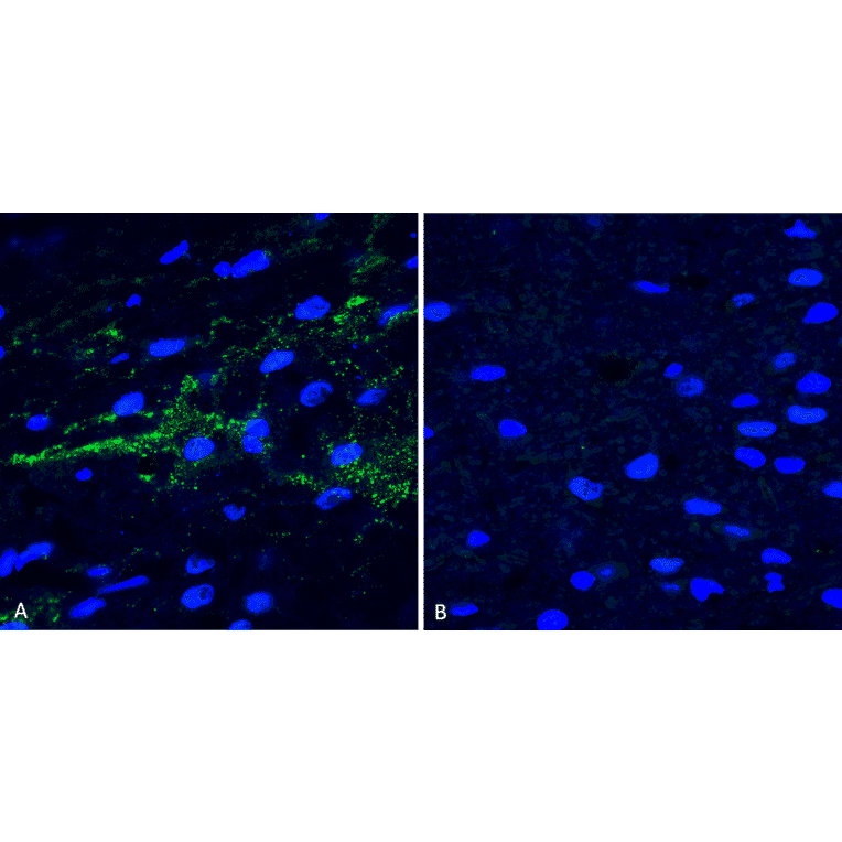 Immunohistochemistry - Anti-alpha Synuclein (phospho Ser129) Antibody (A305044) - Antibodies.com