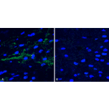 Immunohistochemistry - Anti-alpha Synuclein (phospho Ser129) Antibody (A305044) - Antibodies.com