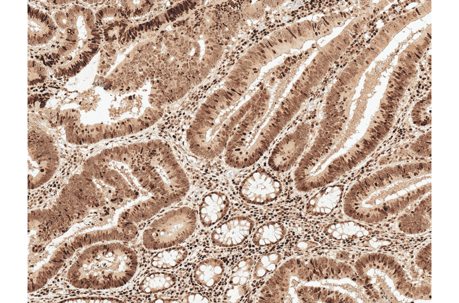 Immunohistochemistry - Anti-MCL1 Antibody (A305045) - Antibodies.com