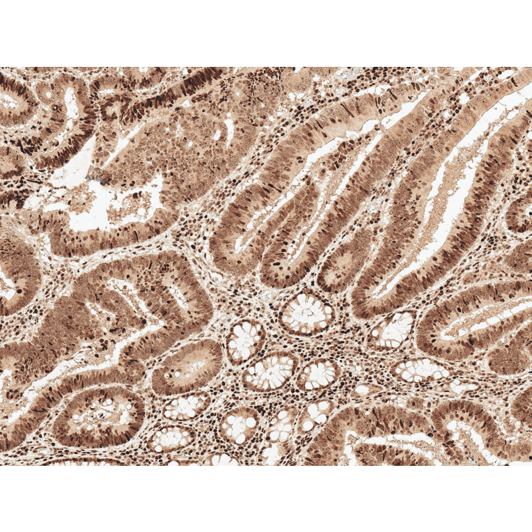 Immunohistochemistry - Anti-MCL1 Antibody (A305045) - Antibodies.com