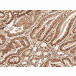 Immunohistochemistry - Anti-MCL1 Antibody (A305045) - Antibodies.com