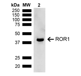 Western Blot - Anti-ROR1 Antibody (A305046) - Antibodies.com