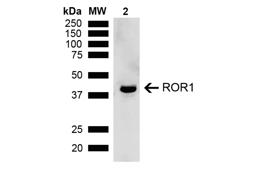 Western Blot - Anti-ROR1 Antibody (A305046) - Antibodies.com