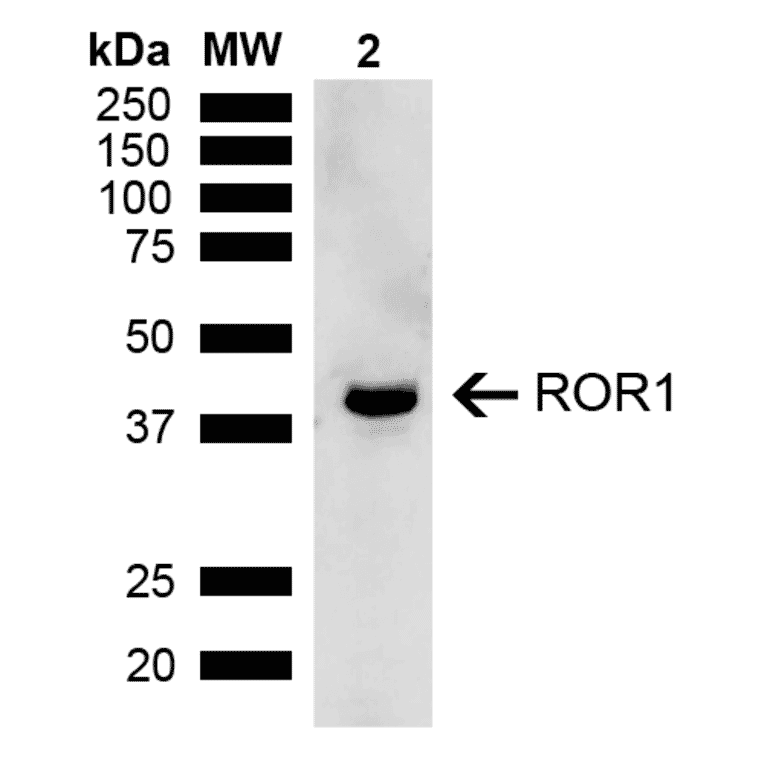 Western Blot - Anti-ROR1 Antibody (A305046) - Antibodies.com