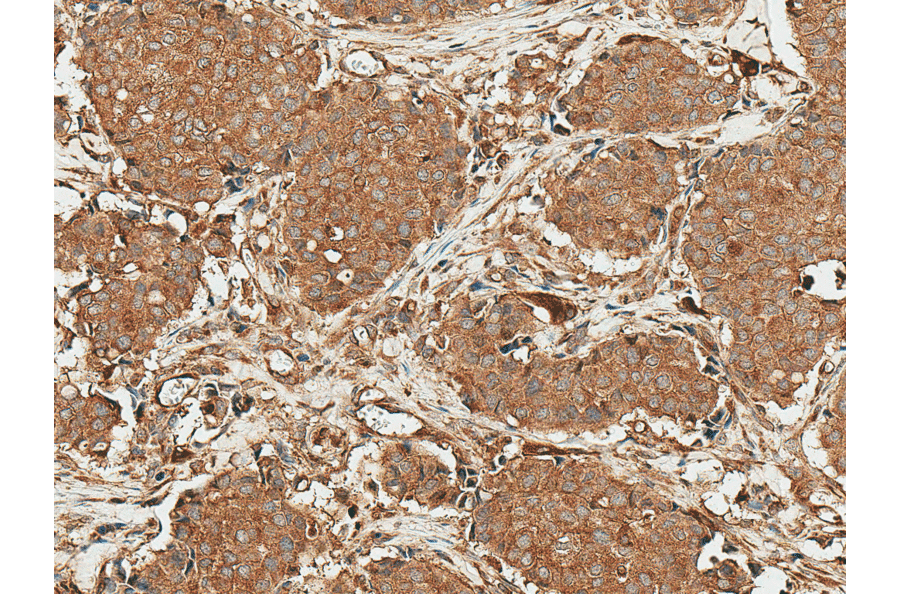 Immunohistochemistry - Anti-ROR1 Antibody (A305046) - Antibodies.com
