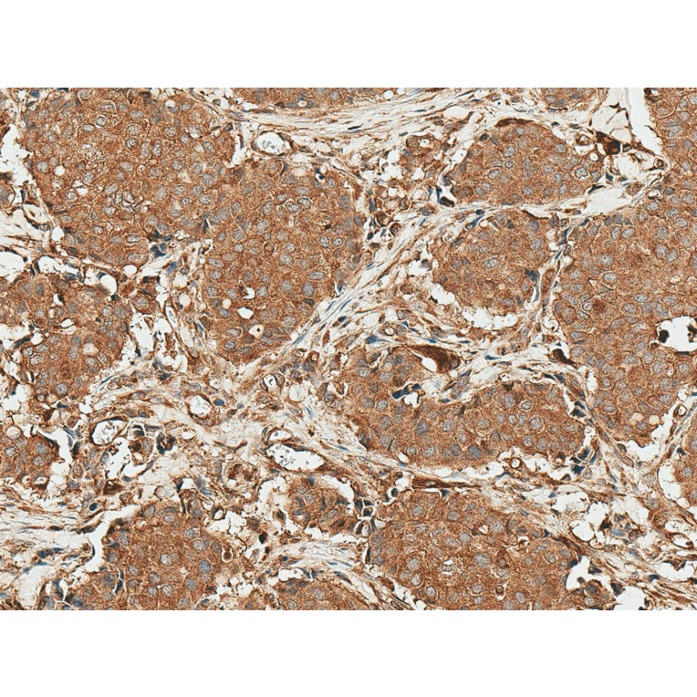 Immunohistochemistry - Anti-ROR1 Antibody (A305046) - Antibodies.com