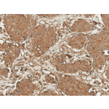Immunohistochemistry - Anti-ROR1 Antibody (A305046) - Antibodies.com