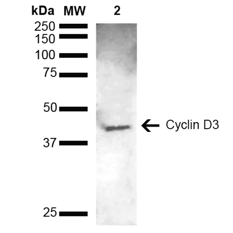 Western Blot - Anti-Cyclin D3 Antibody (A305047) - Antibodies.com