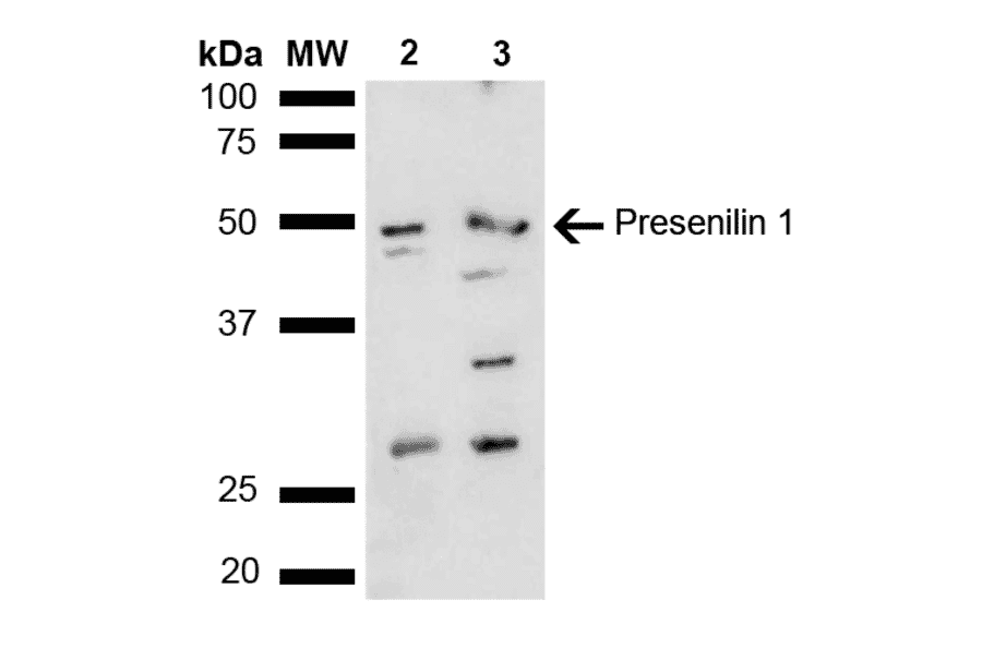 Western Blot - Anti-Presenilin 1 Antibody (A305049) - Antibodies.com