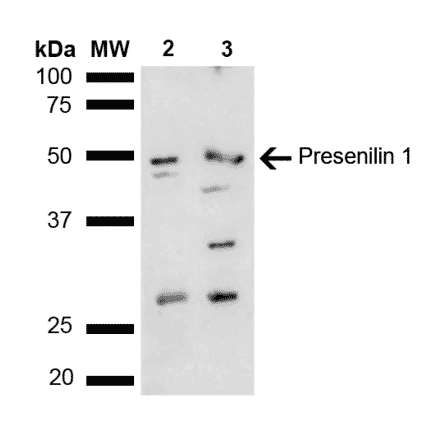 Western Blot - Anti-Presenilin 1 Antibody (A305049) - Antibodies.com