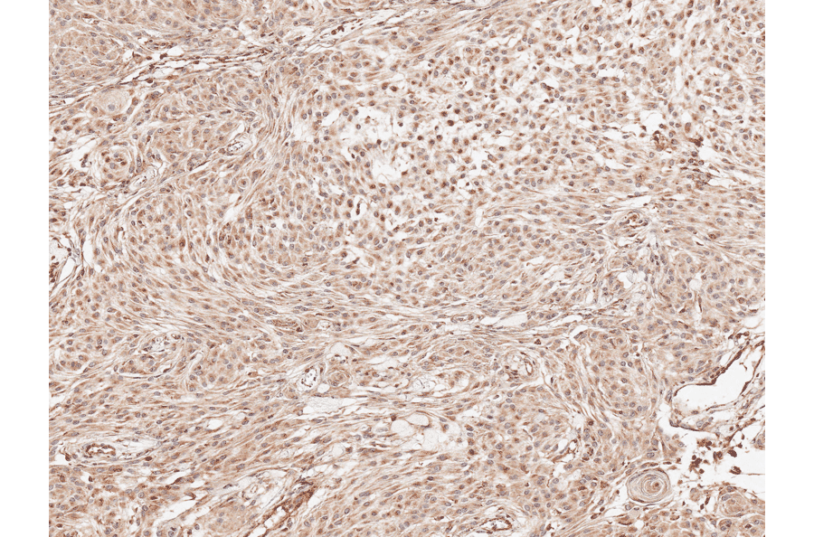 Immunohistochemistry - Anti-Presenilin 1 Antibody (A305049) - Antibodies.com