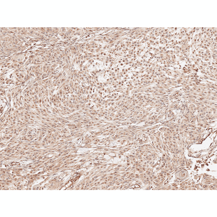 Immunohistochemistry - Anti-Presenilin 1 Antibody (A305049) - Antibodies.com