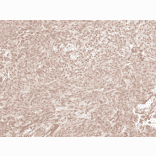 Immunohistochemistry - Anti-Presenilin 1 Antibody (A305049) - Antibodies.com