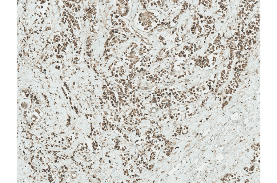 Immunohistochemistry - Anti-AKT1 Antibody (A305050) - Antibodies.com
