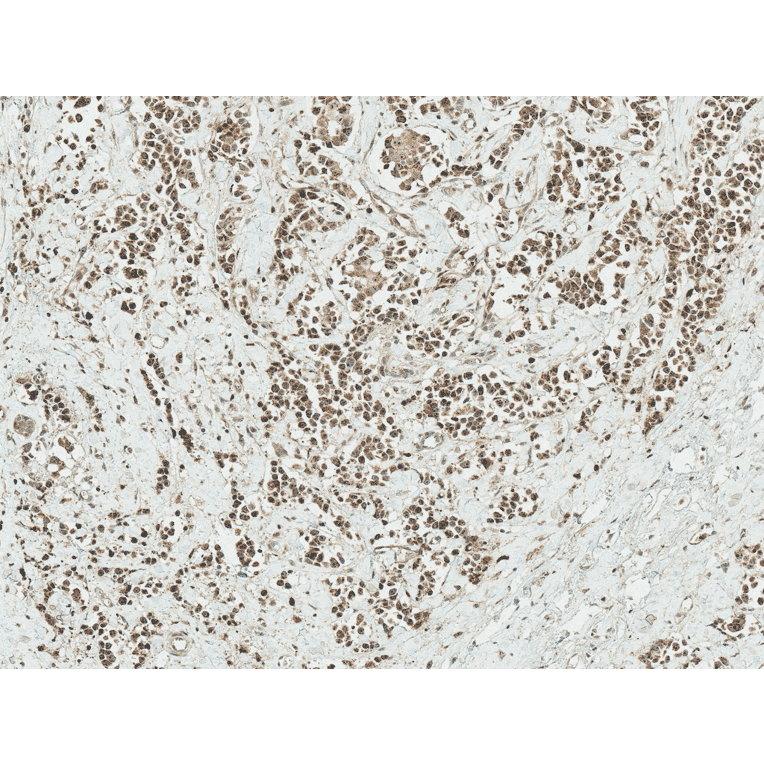 Immunohistochemistry - Anti-AKT1 Antibody (A305050) - Antibodies.com