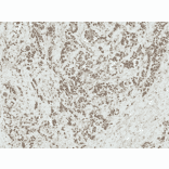 Immunohistochemistry - Anti-AKT1 Antibody (A305050) - Antibodies.com