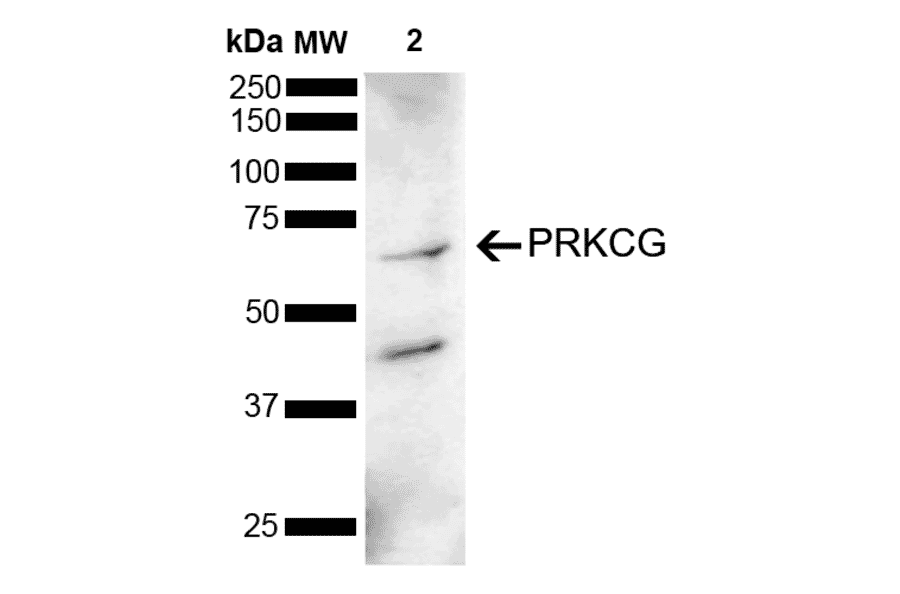 Western Blot - Anti-PKC gamma Antibody (A305051) - Antibodies.com