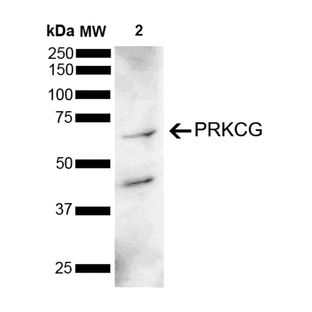 Western Blot - Anti-PKC gamma Antibody (A305051) - Antibodies.com