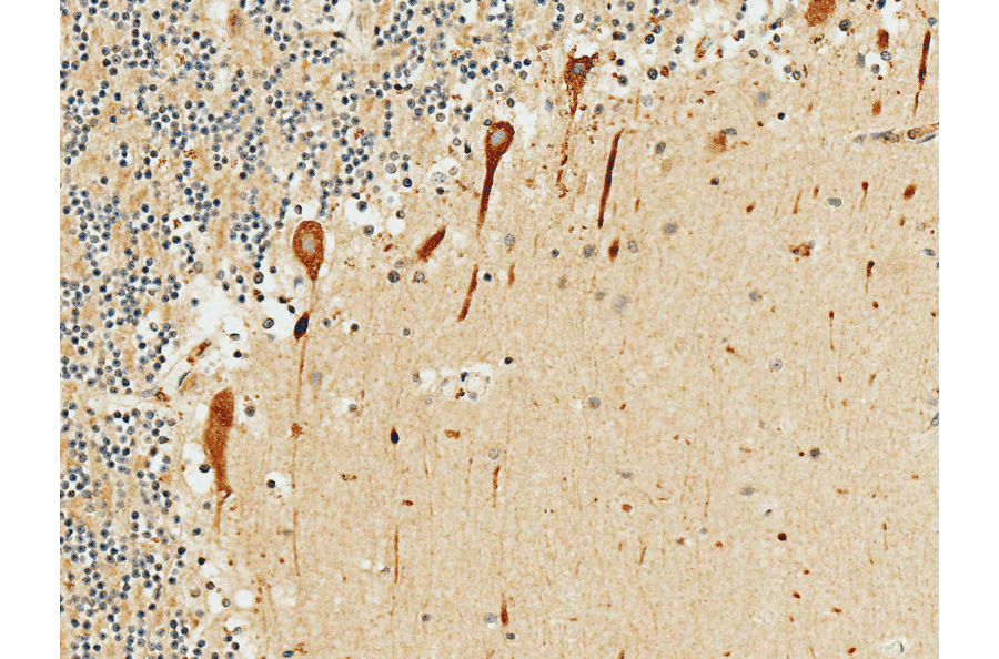 Immunohistochemistry - Anti-PKC gamma Antibody (A305051) - Antibodies.com