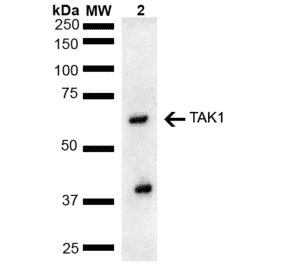 Western Blot - Anti-TAK1 Antibody (A305052) - Antibodies.com
