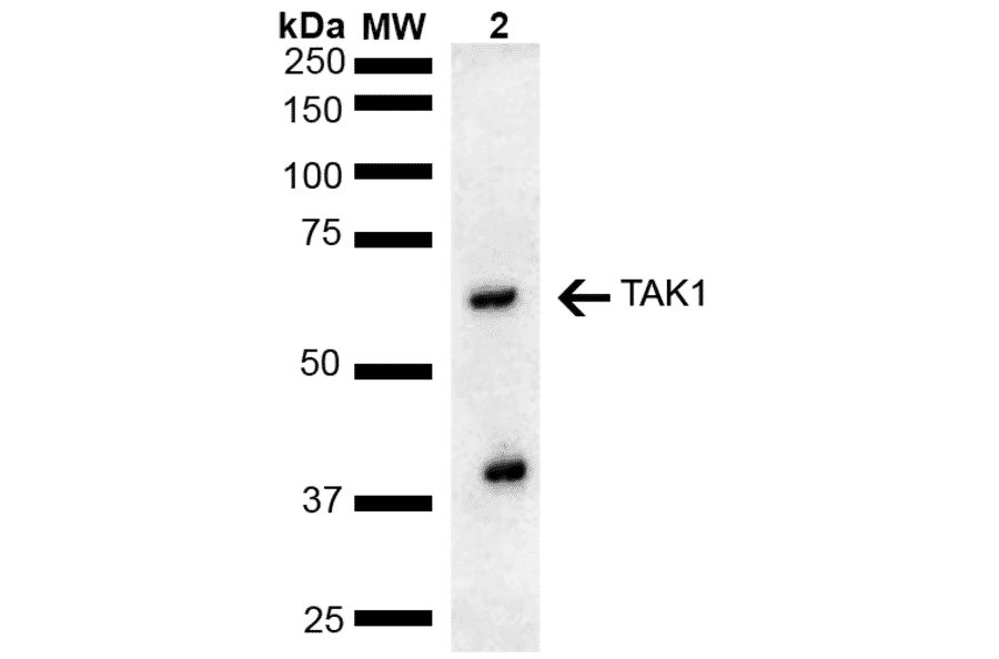 Western Blot - Anti-TAK1 Antibody (A305052) - Antibodies.com