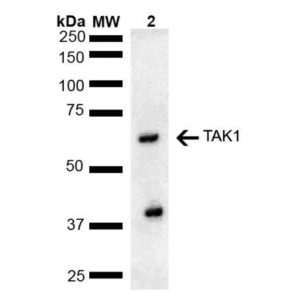 Western Blot - Anti-TAK1 Antibody (A305052) - Antibodies.com