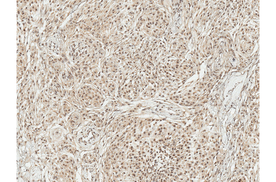 Immunohistochemistry - Anti-TAK1 Antibody (A305052) - Antibodies.com