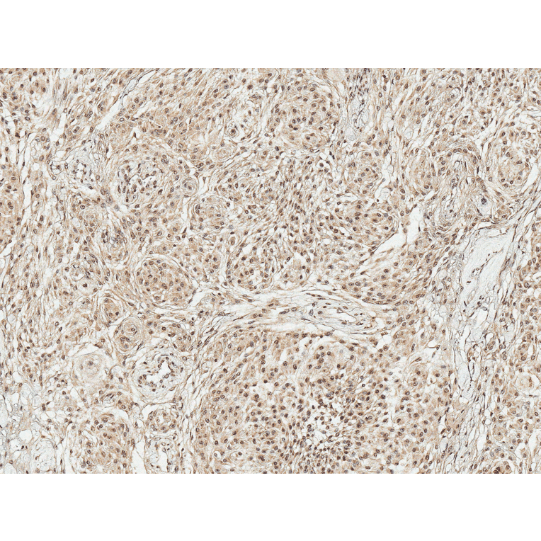 Immunohistochemistry - Anti-TAK1 Antibody (A305052) - Antibodies.com