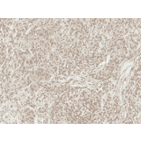 Immunohistochemistry - Anti-TAK1 Antibody (A305052) - Antibodies.com