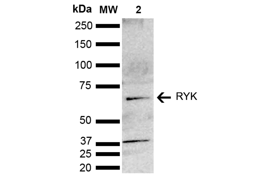 Western Blot - Anti-RYK Antibody (A305053) - Antibodies.com
