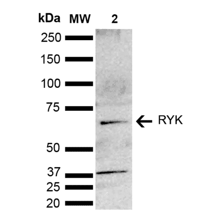 Western Blot - Anti-RYK Antibody (A305053) - Antibodies.com