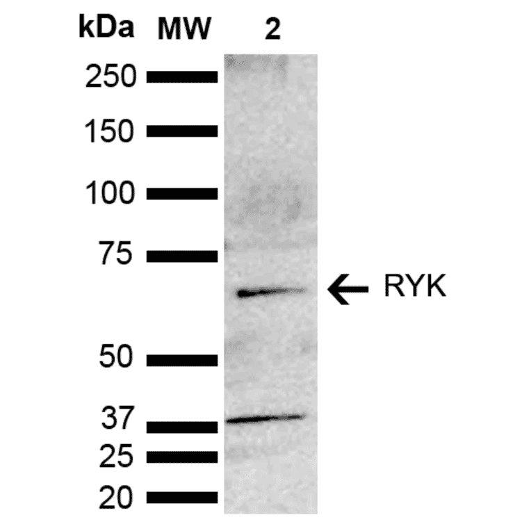 Western Blot - Anti-RYK Antibody (A305053) - Antibodies.com