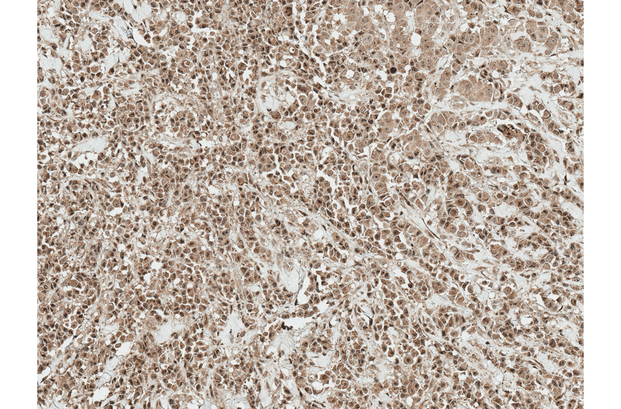 Immunohistochemistry - Anti-RYK Antibody (A305053) - Antibodies.com