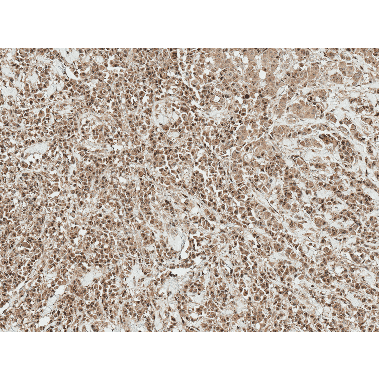 Immunohistochemistry - Anti-RYK Antibody (A305053) - Antibodies.com