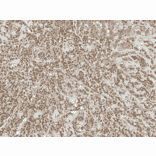 Immunohistochemistry - Anti-RYK Antibody (A305053) - Antibodies.com