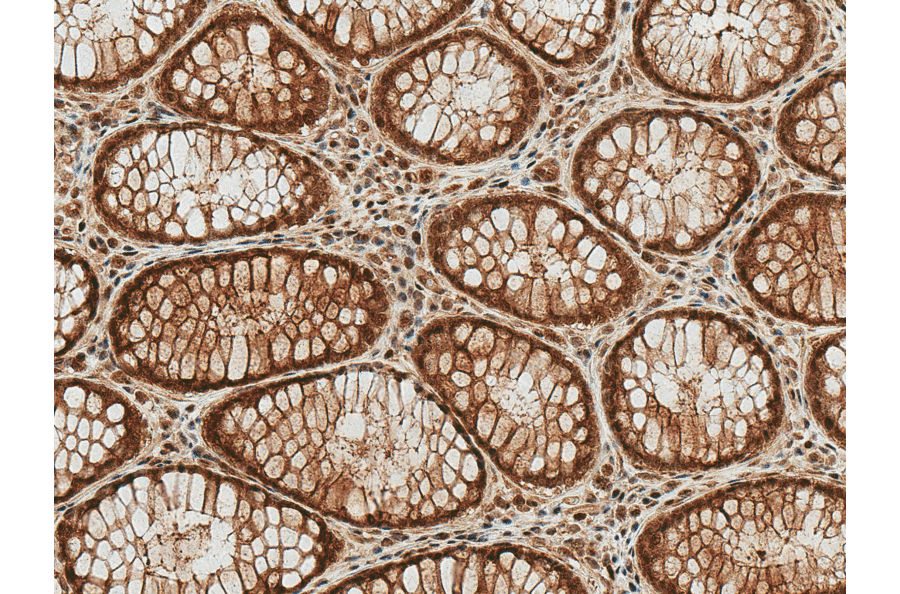 Immunohistochemistry - Anti-HSP70 (acetyl Lys77) Antibody (A305054) - Antibodies.com