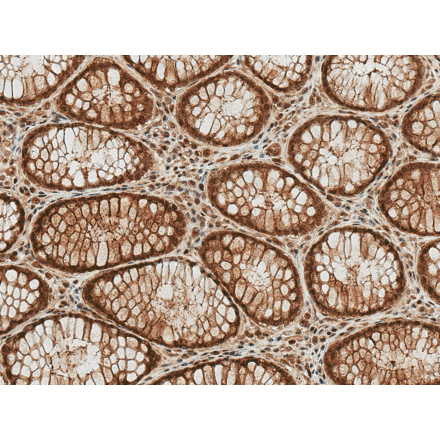 Immunohistochemistry - Anti-HSP70 (acetyl Lys77) Antibody (A305054) - Antibodies.com