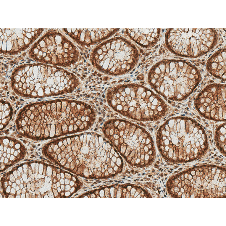 Immunohistochemistry - Anti-HSP70 (acetyl Lys77) Antibody (A305054) - Antibodies.com