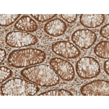 Immunohistochemistry - Anti-HSP70 (acetyl Lys77) Antibody (A305054) - Antibodies.com