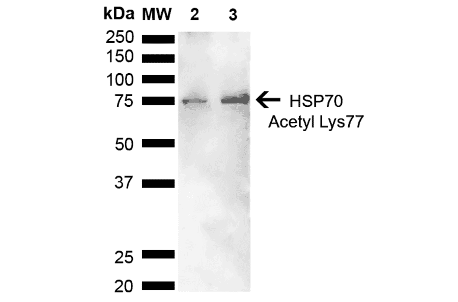 Western Blot - Anti-HSP70 (acetyl Lys77) Antibody (A305054) - Antibodies.com