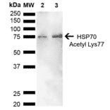 Western Blot - Anti-HSP70 (acetyl Lys77) Antibody (A305054) - Antibodies.com