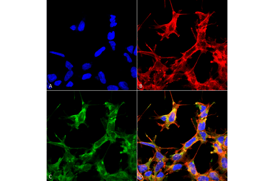 Immunocytochemistry/Immunofluorescence - Anti-HSP70 (acetyl Lys77) Antibody (A305054) - Antibodies.com