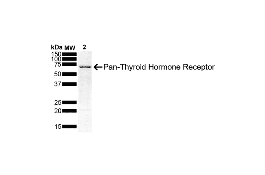 Western Blot - Anti-Thyroid Hormone Receptor Antibody [H43] (A305055) - Antibodies.com