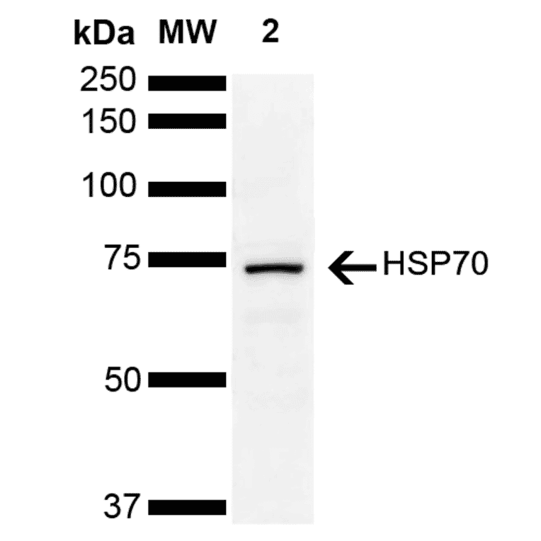 Western Blot - Anti-HSP70 Antibody (A305056) - Antibodies.com