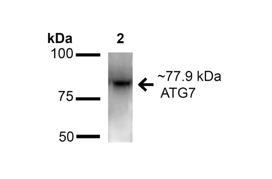 Western Blot - Anti-ATG7 Antibody (A305057) - Antibodies.com